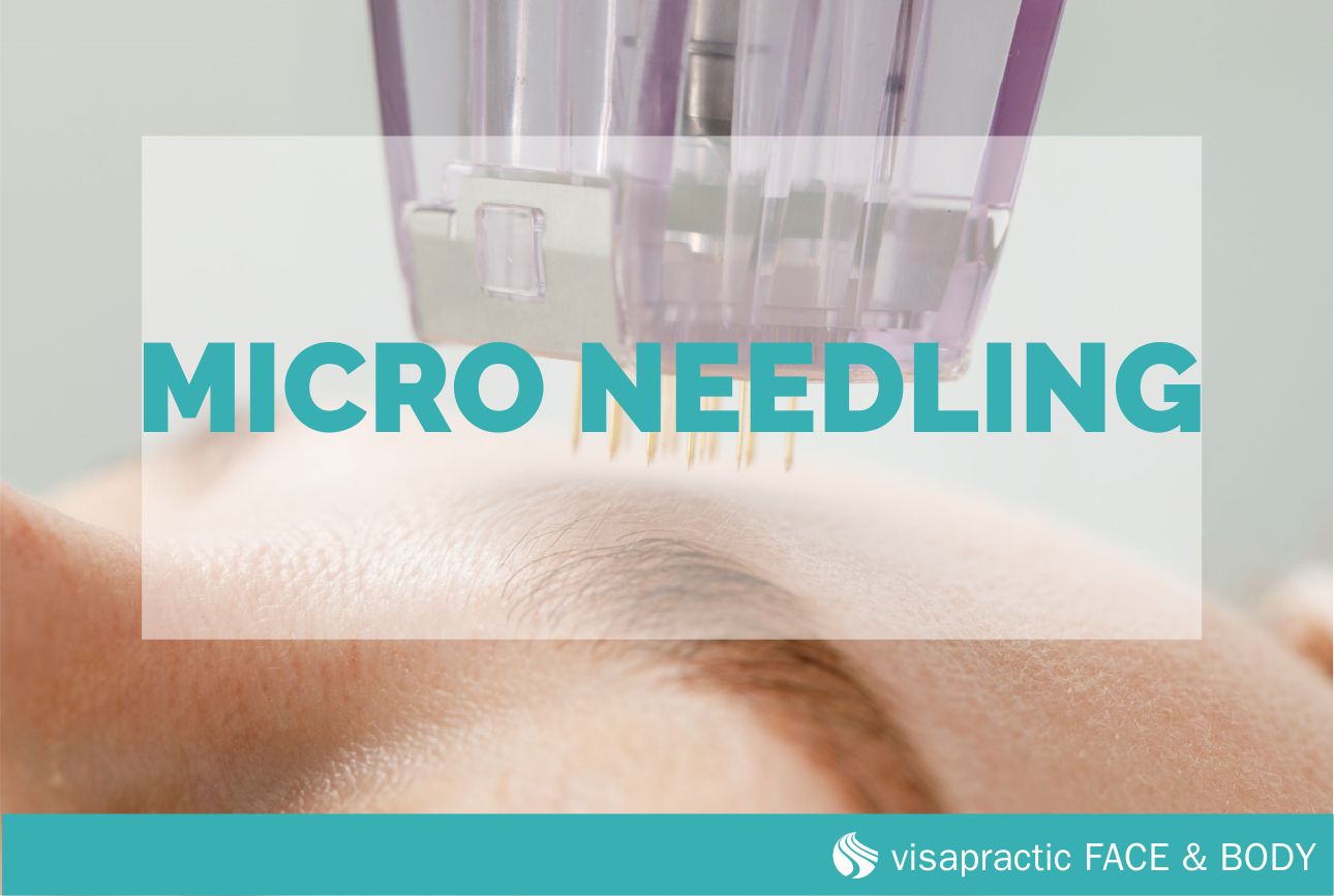 Micro-Needling Gesicht & Body