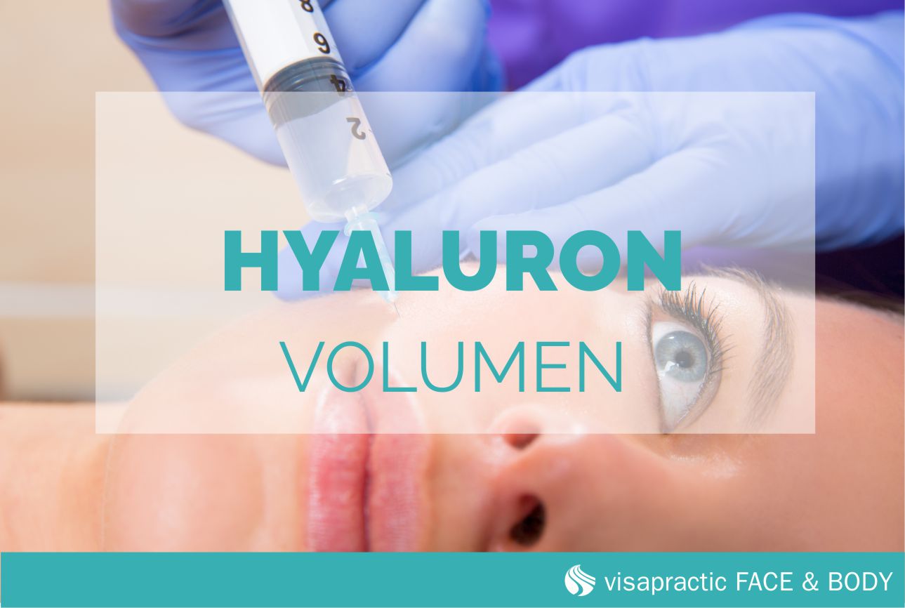 Hyaluron Unterspritzungen zum Volumenaufbau